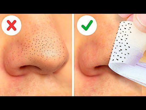 Hai, di video kali ini aku sharing tips aku menghilangkan komedo selama ini. Tips ini aku dapat dari pinterest dan ini sangat .... 