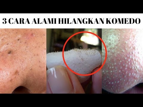 Klik SUBSCRIBE (100% Gratis) : https://www.youtube.com/channel/UCvc00uetYIML9D-7BBrEXLA FOLLOW INSTAGRAM .... 